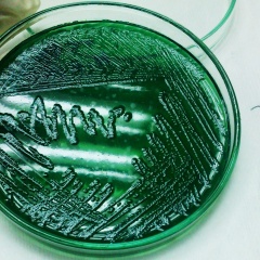 Vibrio diabolicus - Vi khuẩn mới, gây bệnh trên thủy sản